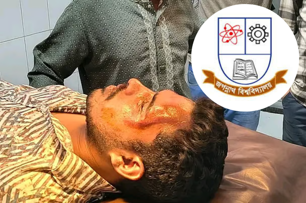 ফুটবল খেলাকে কেন্দ্র করে জবিতে মারামারি, সহকারী প্রক্টরসহ কয়েকজন আহত